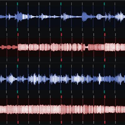 197.Music sets 动态与对比 197.Music sets 动态与对比