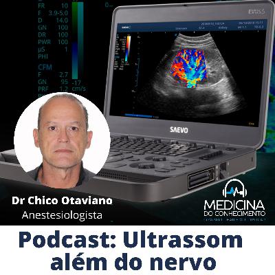 #163 Ultrassom Além Do Nervo #163 Ultrassom Além Do Nervo