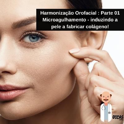 079 Harmonização Orofacial : Parte 01 - Microagulhamento - induzindo a pele a fabricar colágeno!