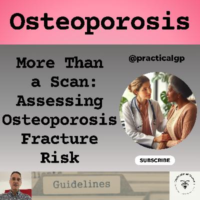 Podcast - Osteoporosis: Assessing Fracture Risk