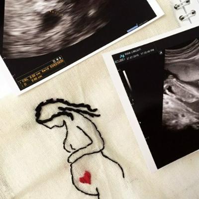 Matahariku (Akhirnya Bertemu Kania)