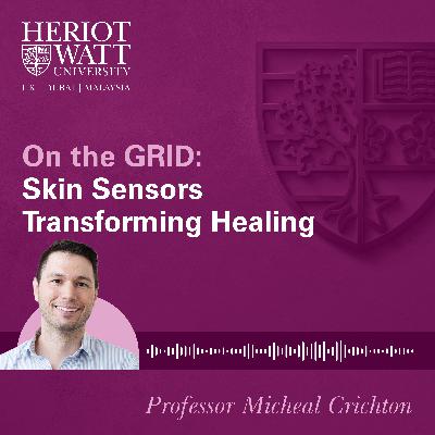On the GRID: Skin Sensors Transforming Healing On the GRID: Skin Sensors Transforming Healing