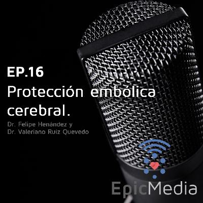 Epic Media - EP 16 Protección Embólica Cerebral