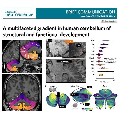 616-Gradients of Structural Human Cerebellar Development