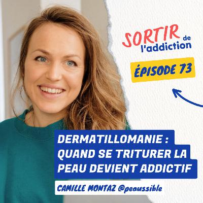 73. Dermatillomanie : quand se triturer la peau devient addictif | Camille Montaz @Peaussible 73. Dermatillomanie : quand se triturer la peau devient addictif | Camille Montaz @Peaussible