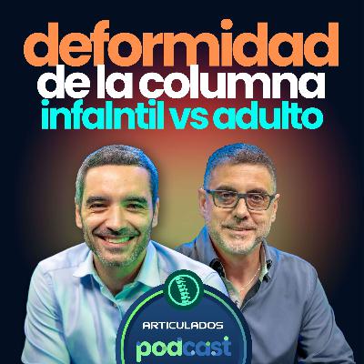 Columna Infantil vs. Adulta: Estrategias para el Manejo de Deformidades Espinales