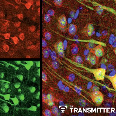 Aging neurons outsource garbage disposal, clog microglia