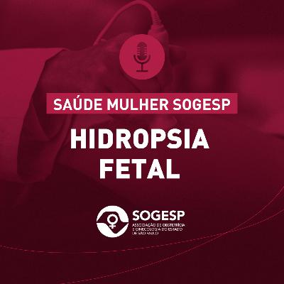 Hidropsia Fetal - Podcast Saúde Mulher SOGESP