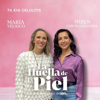 T4. E14. Miren García-Chazarra: Celulitis T4. E14. Miren García-Chazarra: Celulitis