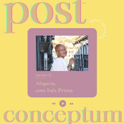 Episódio 6: Alopecia, com Inês Primo