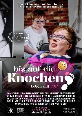 Bewegender Xinedome-Kinoabend: „Bis auf die Knochen – Leben mit FOP“