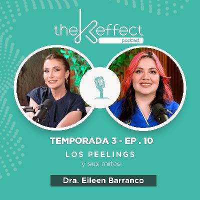 ✨ Los peelings y sus mitos ✨