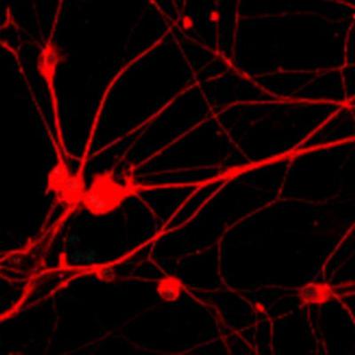 Could the progression of glaucoma be halted?