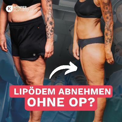 #215 Trotz Lipödem über 20 Kilo leichter – und das ganz ohne OP?!