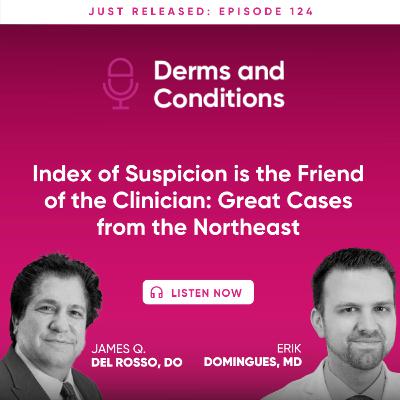 Index of Suspicion is the Friend of the Clinician: Great Cases from the Northeast