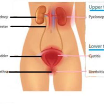 S5E7: "Do You Have Urinary Symptoms Related To Long COVID?"