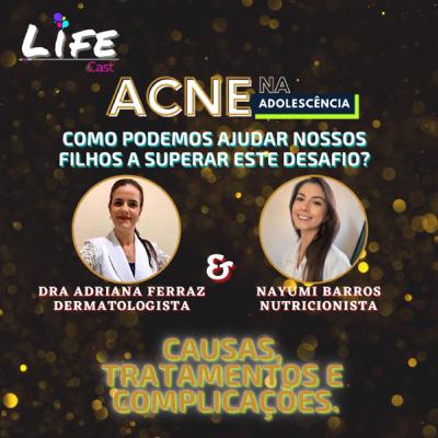 Acne na Adolescência