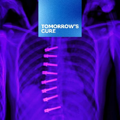 Shaping a New Future for Youth with Scoliosis