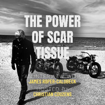 JAMES ROPER-CALDBECK, THE POWER OF SCAR TISSUE