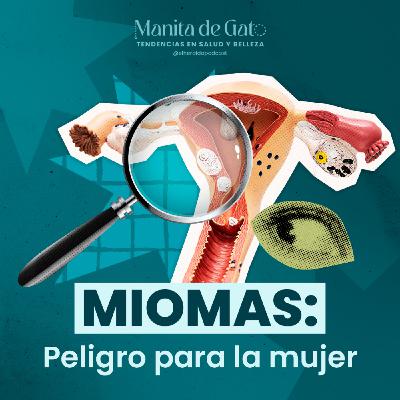 Miomatosis Uterina: Lo que Toda Mujer Debe Saber