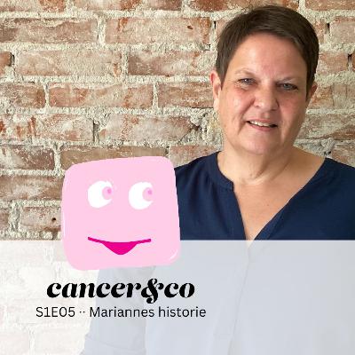 S1E05 ·· Ødemer efter operation gjorde Marianne til daglig pendler