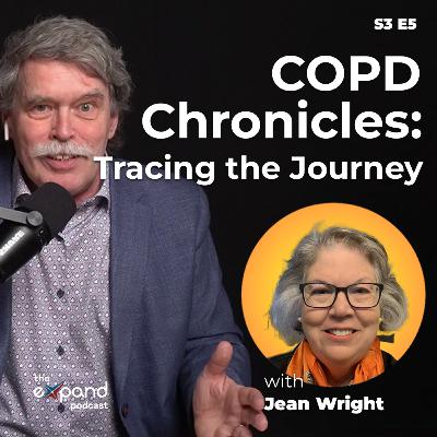 COPD Chronicles: Tracing the journey COPD Chronicles: Tracing the journey