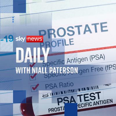 Why David Cameron’s calling for more cancer screening