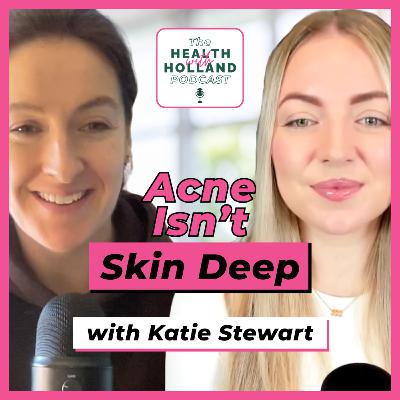 Adult Acne Isn’t Just About Skincare: Understanding the Bigger Picture Behind Persistent Breakouts Adult Acne Isn’t Just About Skincare: Understanding the Bigger Picture Behind Persistent Breakouts