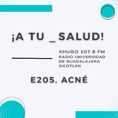 E205. ¡A Tu Salud! - Acné