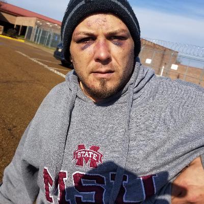 In a Mississippi Jail, Inmates Became Weapons In a Mississippi Jail, Inmates Became Weapons