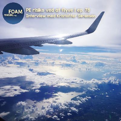 PE risiko ved at flyve | ep. 78