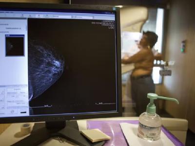 AMAMA analizará los casos de fallecimientos por cáncer de mama tras las denuncias por retrasos en las pruebas diagnósticas: "Tenemos varios casos de mujeres muertas por esto"