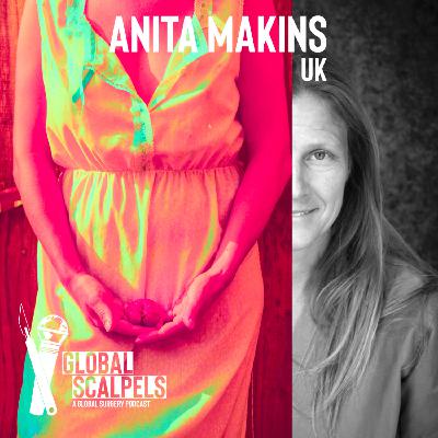 Ep 44: Anita Makins