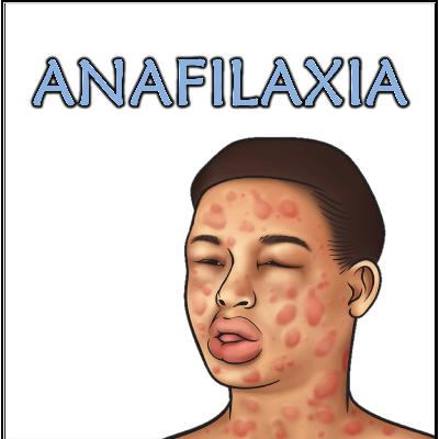 EP 02 – Anafilaxia Intraoperatória