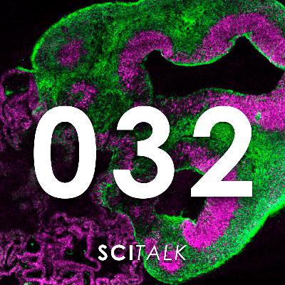 #32 — A Revolução dos Minicérebros