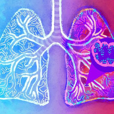 Genecast #029 - Fibrose Cística