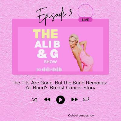 The Tits Are Gone, But the Bond Remains: Ali Bond’s Breast Cancer Story