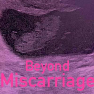 Beyond Miscarriage: Episode One, My story.