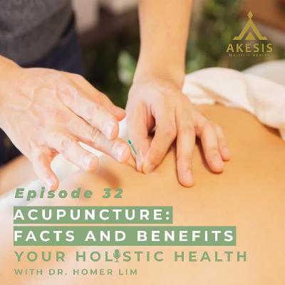 Ep 32: Acupuncture | Facts and Benefits