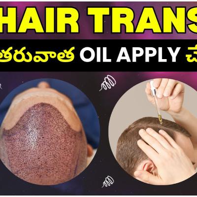 Can I use hair oil immediately after a hair transplant procedure? Can I use hair oil immediately after a hair transplant procedure?