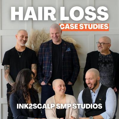 Restoring Confidence Through Scar Camouflage with SMP-Case Study 10