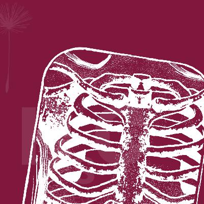 Radiaciones y accidentes