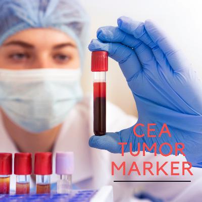 CANCER - CEA Tumor Marker