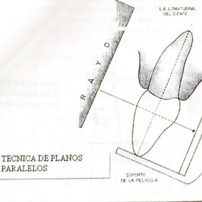 Técnica radiografíca de planos parelelos