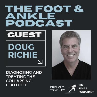 Diagnosing and treating the collapsing flatfoot with Dr Doug Richie Diagnosing and treating the collapsing flatfoot with Dr Doug Richie
