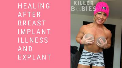 Healing after Breast Implant Illness and Explant