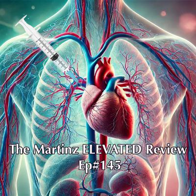 The Martinz ELEVATED Review - Ep#145 - with Marc Girardot "Never Let Go of a Red Flag"