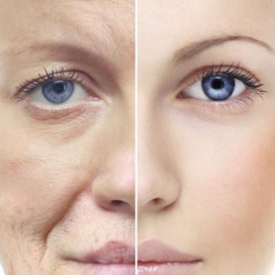 EL COLÁGENO, TIPOS, BENEFICIOS, FUENTES RICAS DE COLÁGENO👩⚕️ Aprende Fácil y Sencillo sobre Salud y Medicina ❤️️ EL COLÁGENO, TIPOS, BENEFICIOS, FUENTES RICAS DE COLÁGENO👩⚕️ Aprende Fácil y Sencillo sobre Salud y Medicina ❤️️