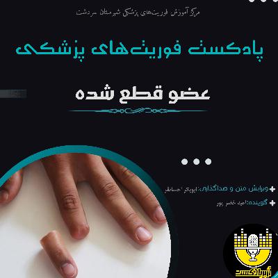 پروتکل آفلاین ترومای عضو قطع شده