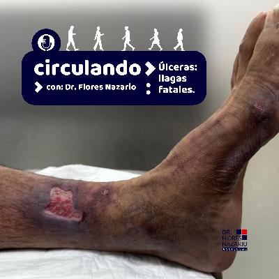 Úlceras: llagas fatales. Úlceras: llagas fatales.